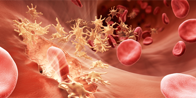 Poremećaji zgrušavanja krvi