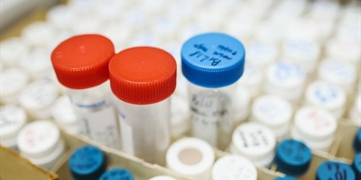 Kako u RH postići standard antidoping kontrole koji propisuje WADA